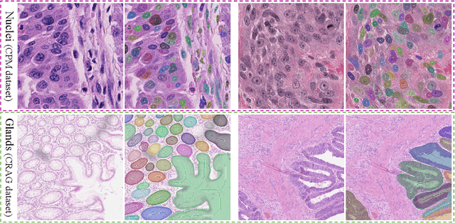 Figure 4 for NuClick: A Deep Learning Framework for Interactive Segmentation of Microscopy Images