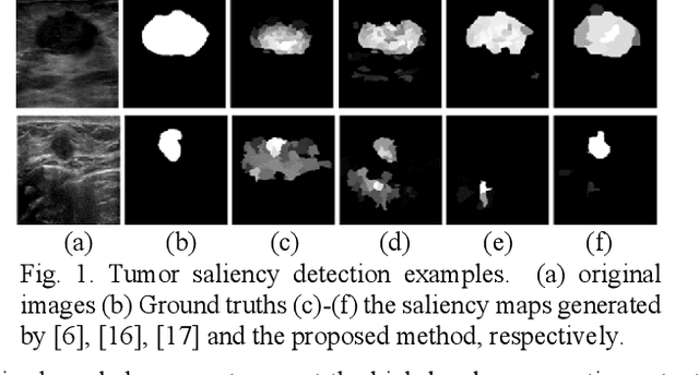 Figure 1 for Breast Anatomy Enriched Tumor Saliency Estimation