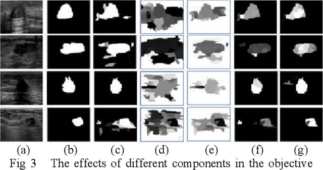 Figure 3 for Breast Anatomy Enriched Tumor Saliency Estimation