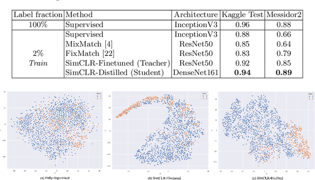 Figure 2 for Deep Semi-Supervised and Self-Supervised Learning for Diabetic Retinopathy Detection
