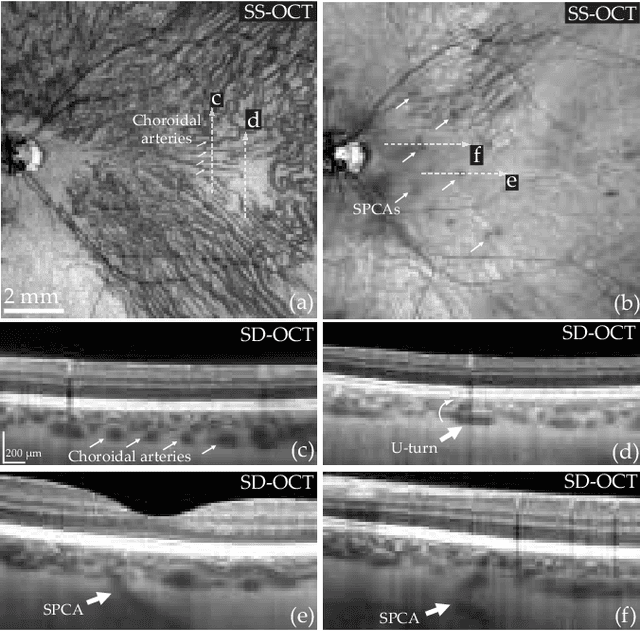 Figure 4 for Choroidal vasculature imaging with laser Doppler holography