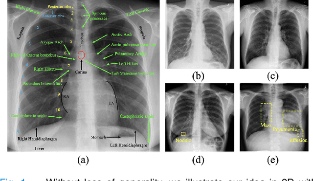 Figure 1 for Transferable Visual Words: Exploiting the Semantics of Anatomical Patterns for Self-supervised Learning