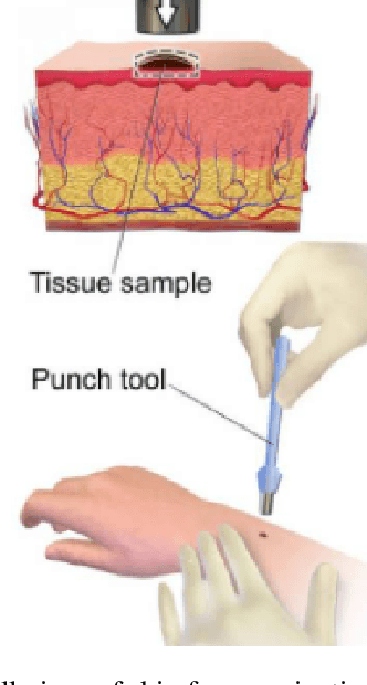 Figure 3 for Skin disease diagnosis using image analysis and natural language processing
