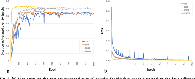 Figure 4 for Improved Segmentation and Detection Sensitivity of Diffusion-Weighted Brain Infarct Lesions with Synthetically Enhanced Deep Learning
