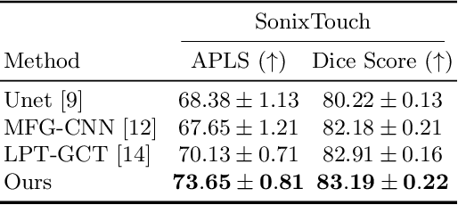 Figure 2 for Orientation-guided Graph Convolutional Network for Bone Surface Segmentation