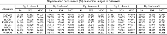 Figure 4 for Residual-driven Fuzzy C-Means Clustering for Image Segmentation
