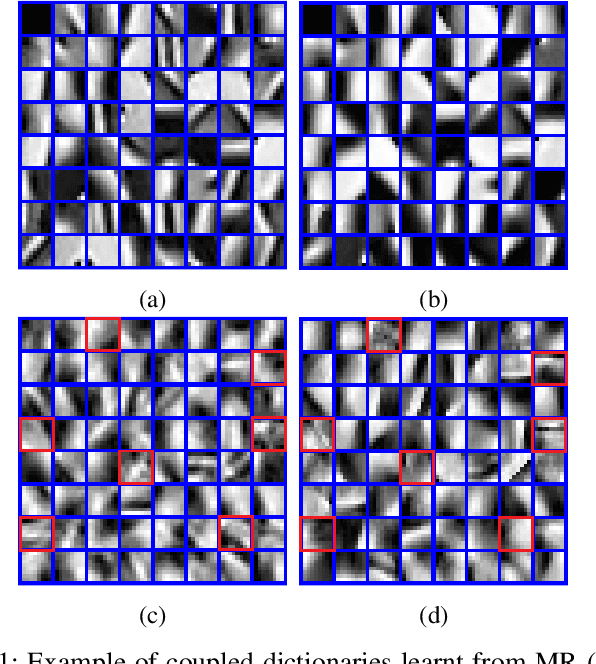 Figure 1 for Coupled Feature Learning for Multimodal Medical Image Fusion