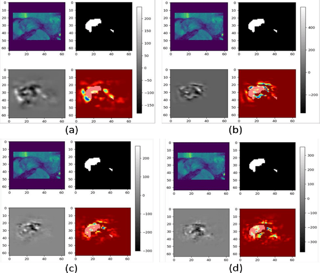 Figure 1 for Robustness of different loss functions and their impact on networks learning capability