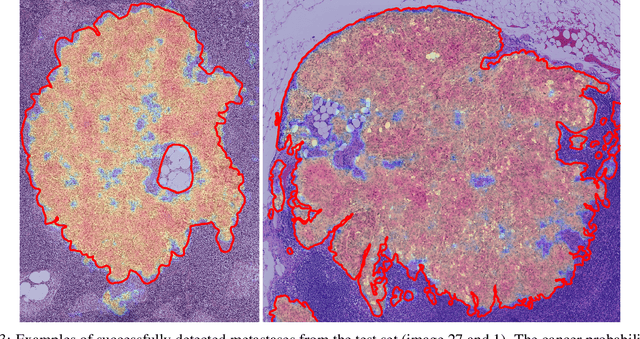 Figure 3 for Weakly supervised training of pixel resolution segmentation models on whole slide images
