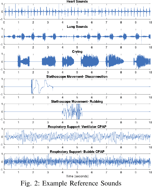 Figure 2 for Noisy Neonatal Chest Sound Separation for High-Quality Heart and Lung Sounds