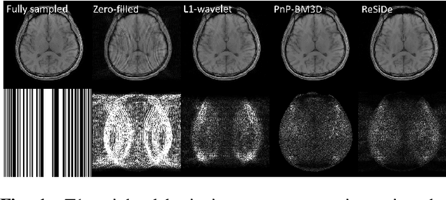 Figure 1 for MRI Recovery with A Self-calibrated Denoiser