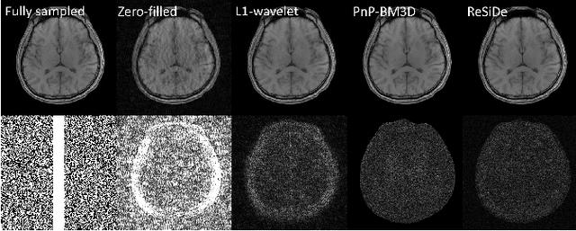 Figure 3 for MRI Recovery with A Self-calibrated Denoiser