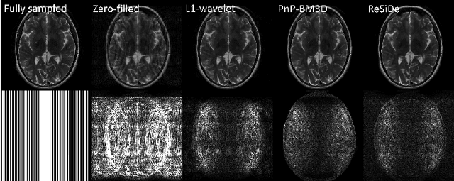 Figure 4 for MRI Recovery with A Self-calibrated Denoiser