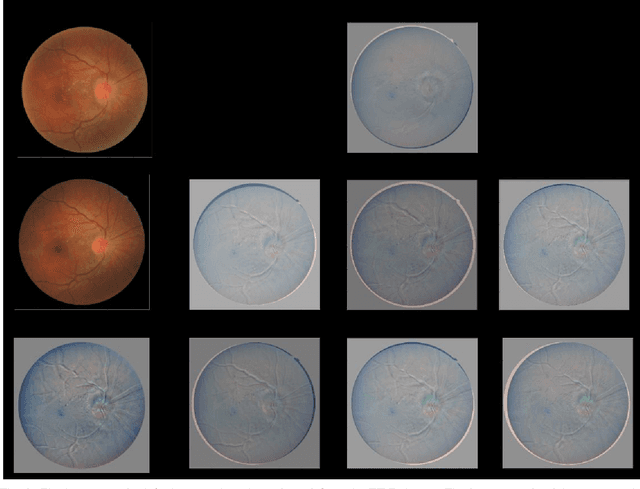 Figure 2 for DRMIME: Differentiable Mutual Information and Matrix Exponential for Multi-Resolution Image Registration