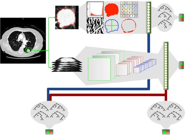 Figure 1 for Highly accurate model for prediction of lung nodule malignancy with CT scans