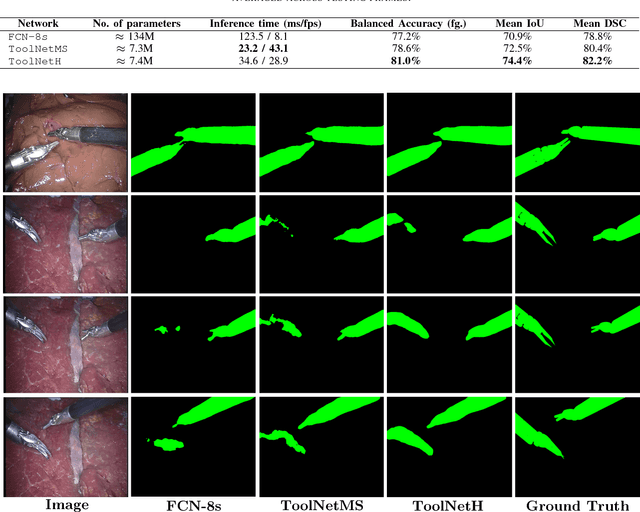 Figure 3 for ToolNet: Holistically-Nested Real-Time Segmentation of Robotic Surgical Tools
