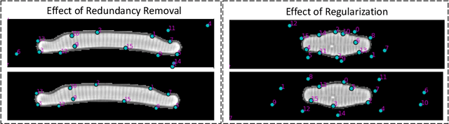 Figure 2 for Leveraging Unsupervised Image Registration for Discovery of Landmark Shape Descriptor