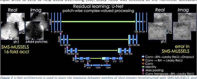 Figure 2 for Highly Accelerated Multishot EPI through Synergistic Combination of Machine Learning and Joint Reconstruction
