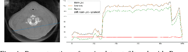 Figure 4 for Precision Learning: Reconstruction Filter Kernel Discretization
