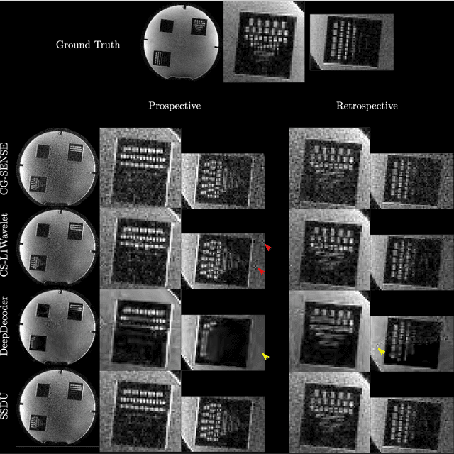 Figure 3 for Validation and Generalizability of Self-Supervised Image Reconstruction Methods for Undersampled MRI