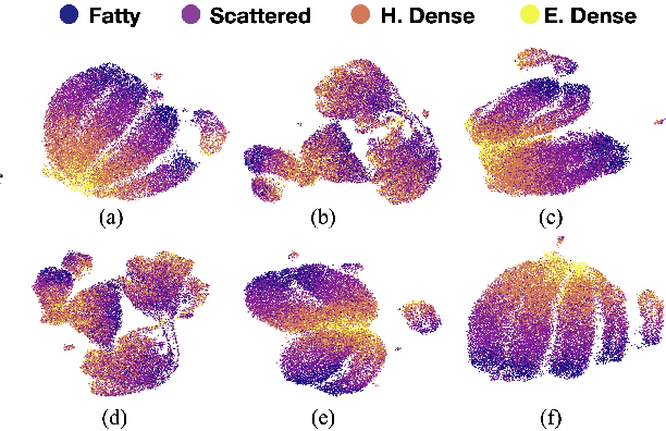 Figure 4 for The unreasonable effectiveness of Batch-Norm statistics in addressing catastrophic forgetting across medical institutions