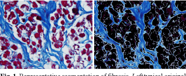 Figure 1 for Segmentation of histological images and fibrosis identification with a convolutional neural network