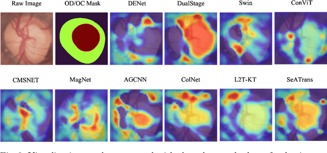 Figure 3 for SeATrans: Learning Segmentation-Assisted diagnosis model via Transformer