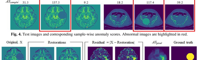 Figure 4 for Anomaly detection through latent space restoration using vector-quantized variational autoencoders