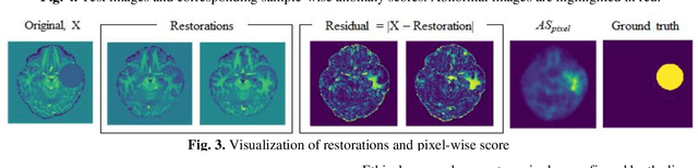 Figure 2 for Anomaly detection through latent space restoration using vector-quantized variational autoencoders