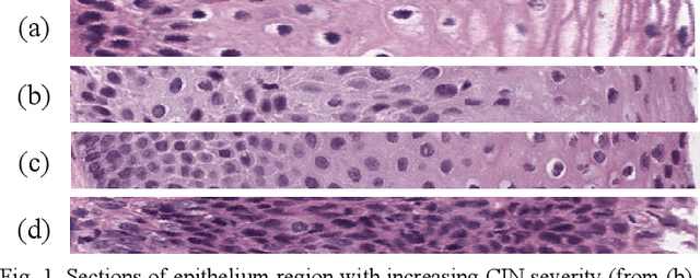 Figure 1 for Feature based Sequential Classifier with Attention Mechanism