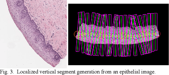 Figure 3 for Feature based Sequential Classifier with Attention Mechanism