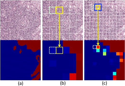 Figure 2 for A Robust and Effective Approach Towards Accurate Metastasis Detection and pN-stage Classification in Breast Cancer