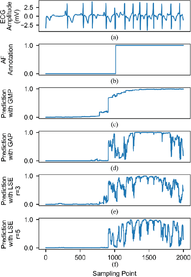 Figure 4 for Weakly Supervised Arrhythmia Detection Based on Deep Convolutional Neural Network
