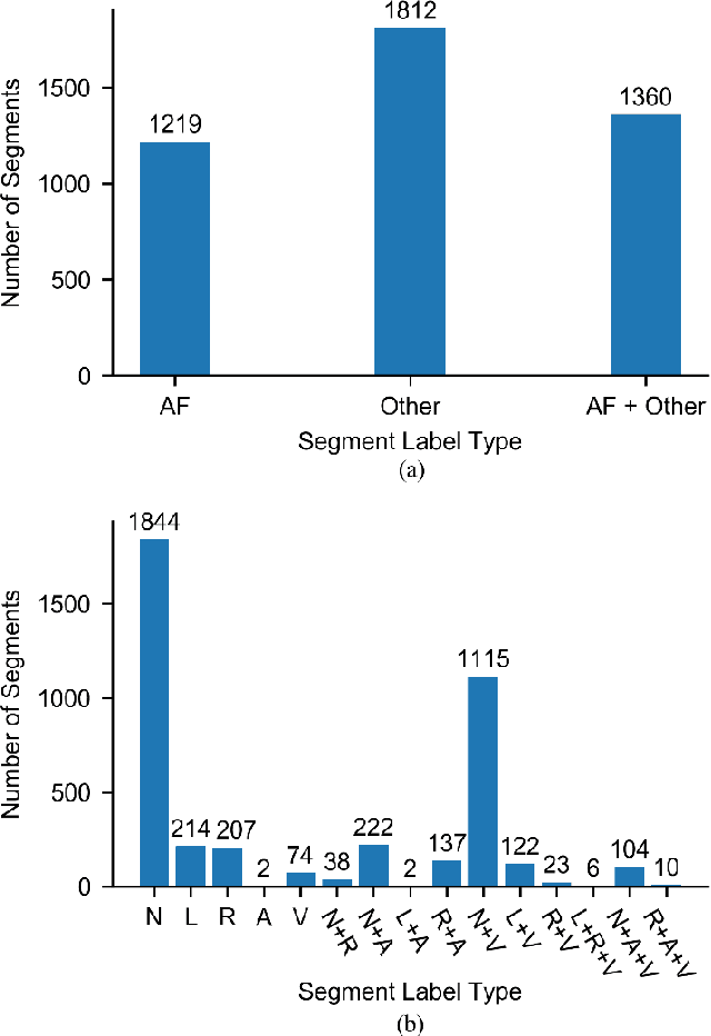 Figure 3 for Weakly Supervised Arrhythmia Detection Based on Deep Convolutional Neural Network