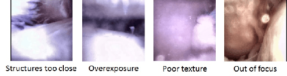 Figure 1 for Self-supervised Depth Estimation to Regularise Semantic Segmentation in Knee Arthroscopy