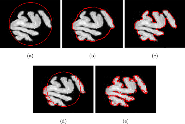 Figure 3 for Using the Split Bregman Algorithm to Solve the Self-Repelling Snake Model