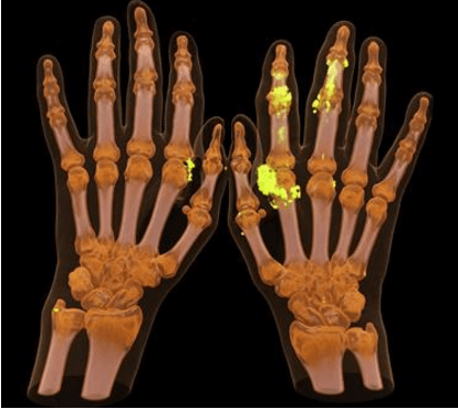 Figure 2 for Shaping the Future through Innovations: From Medical Imaging to Precision Medicine
