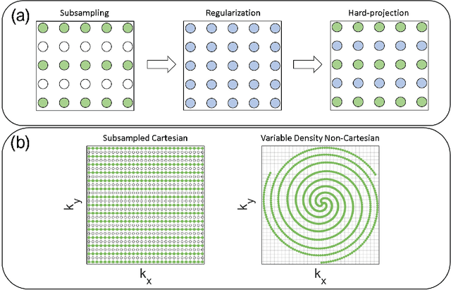 Figure 1 for Reconstruction of Undersampled 3D Non-Cartesian Image-Based Navigators for Coronary MRA Using an Unrolled Deep Learning Model