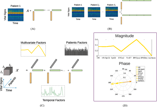 Figure 4 for Analysis of Intra-Operative Physiological Responses Through Complex Higher-Order SVD for Long-Term Post-Operative Pain Prediction