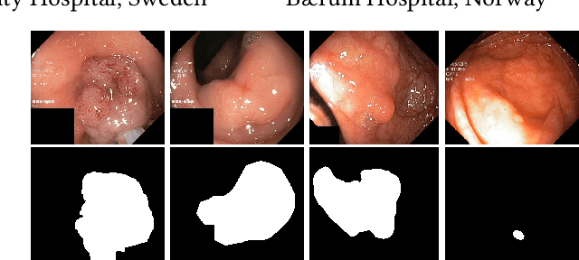 Figure 1 for Medico Multimedia Task at MediaEval 2020: Automatic Polyp Segmentation