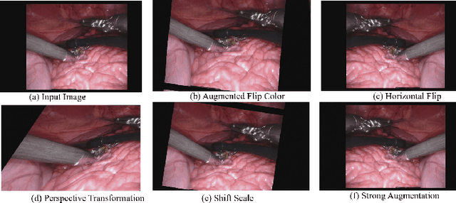 Figure 2 for U-NetPlus: A Modified Encoder-Decoder U-Net Architecture for Semantic and Instance Segmentation of Surgical Instrument
