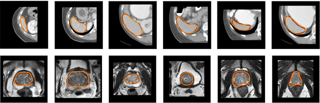 Figure 1 for Subpixel object segmentation using wavelets and multi resolution analysis