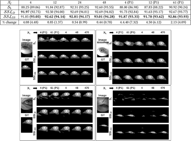 Figure 3 for Semi-Supervised Learning for Eye Image Segmentation