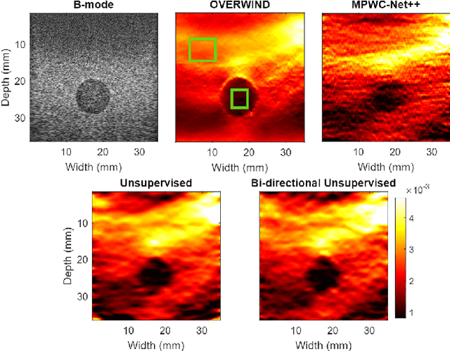 Figure 4 for Bi-Directional Semi-Supervised Training of Convolutional Neural Networks for Ultrasound Elastography Displacement Estimation