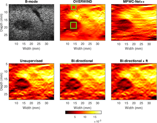 Figure 2 for Bi-Directional Semi-Supervised Training of Convolutional Neural Networks for Ultrasound Elastography Displacement Estimation