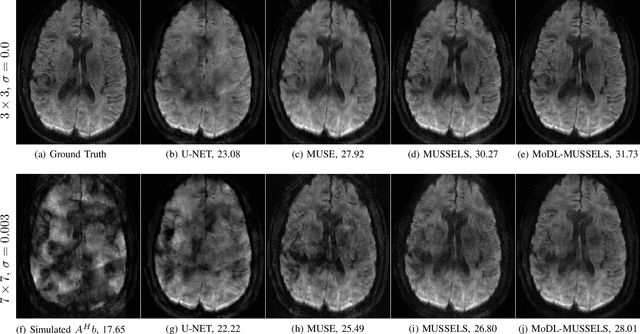 Figure 4 for Multi-Shot Sensitivity-Encoded Diffusion MRI using Model-Based Deep Learning (MODL-MUSSELS)