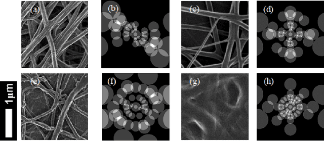 Figure 3 for What do we need to build explainable AI systems for the medical domain?