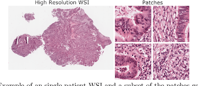 Figure 1 for Patient-level Microsatellite Stability Assessment from Whole Slide Images By Combining Momentum Contrast Learning and Group Patch Embeddings