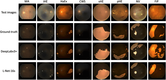 Figure 3 for Learn to Segment Retinal Lesions and Beyond