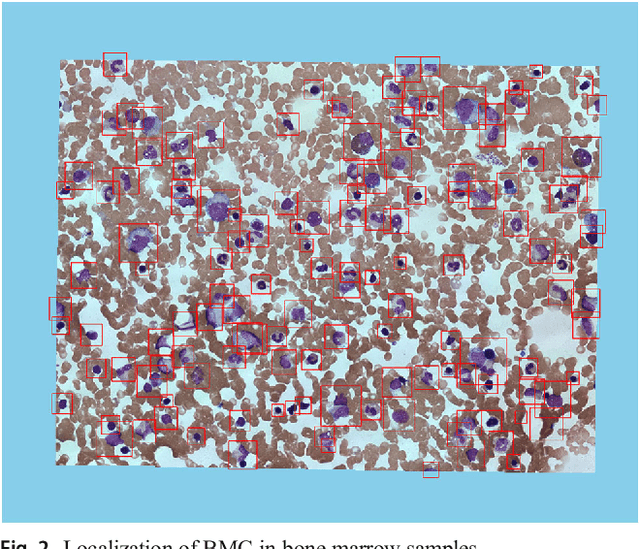 Figure 3 for Bone marrow cells detection: A technique for the microscopic image analysis